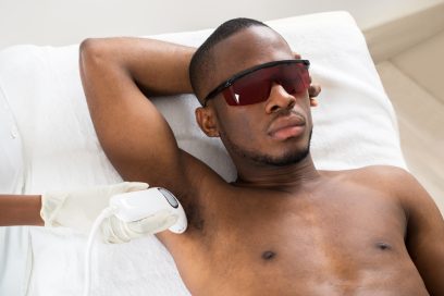 Laser Hair Removal for Men NYC