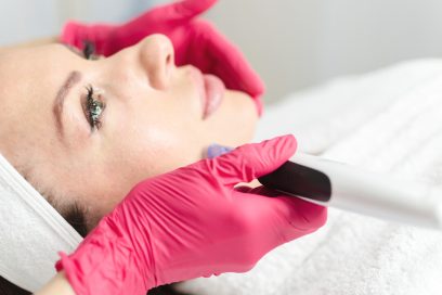 Vivace Microneedling