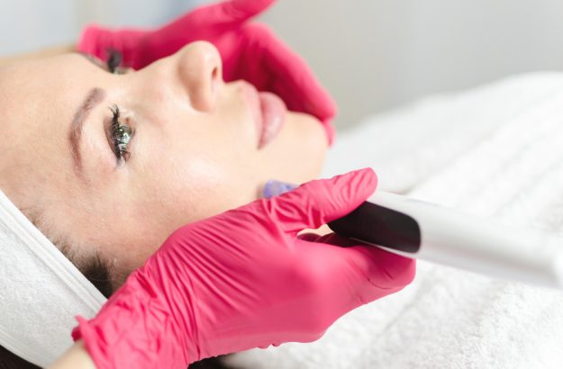 Vivace Microneedling