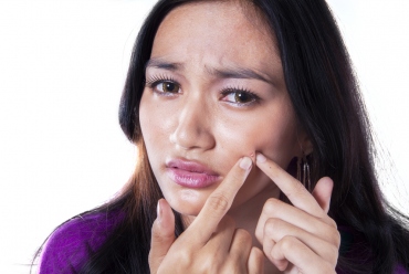 How to Remove Blackheads Like a Pro