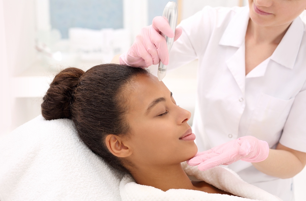 Is Microneedling Safe For Skin of Color?