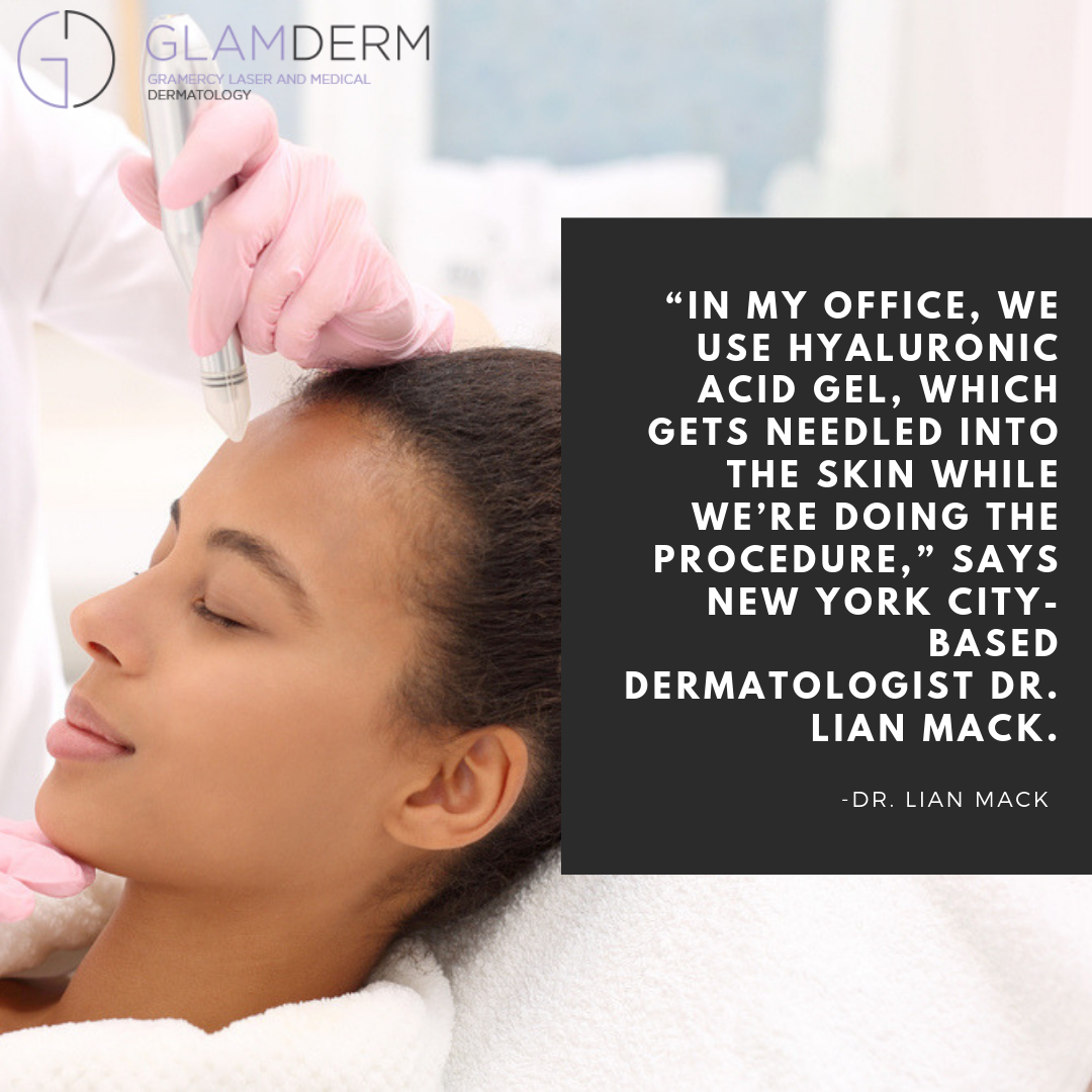 “In my office, we use hyaluronic acid gel, which gets needled into the skin while we’re doing the procedure,” says New York City-based dermatologist Dr. Lian Mack.