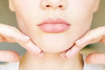 Kybella Double Chin