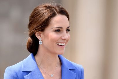 Kate Middleton Botox